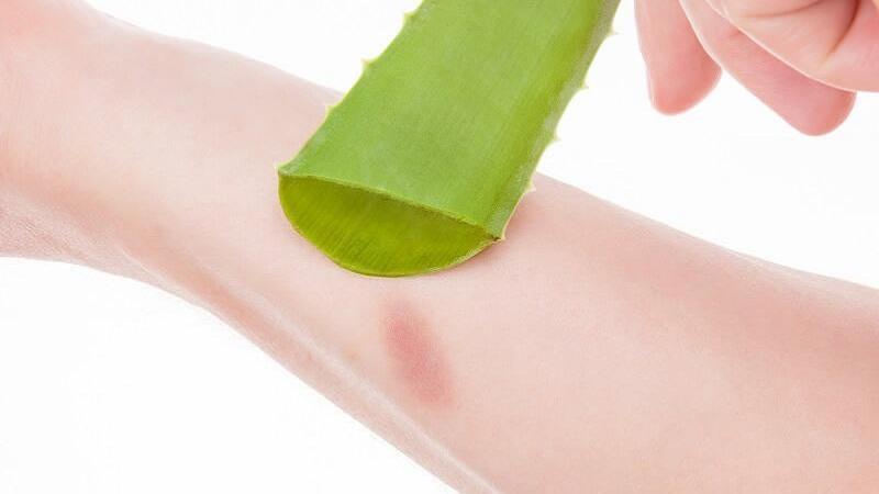 Các chuyên gia da liễu đánh giá việc sử dụng gel lô hội trên da là an toàn.