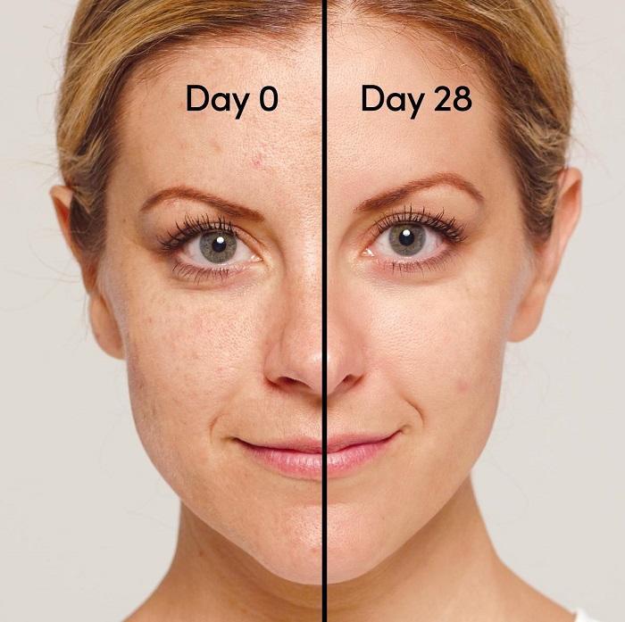 da thay đổi sau khi sử dụng retinol 28 ngày